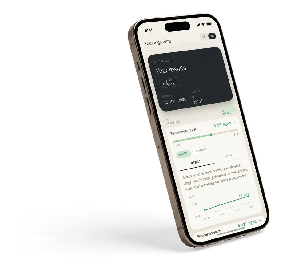 Remi Health Ergebnisportal auf einem angewinkelten Smartphone-Mockup